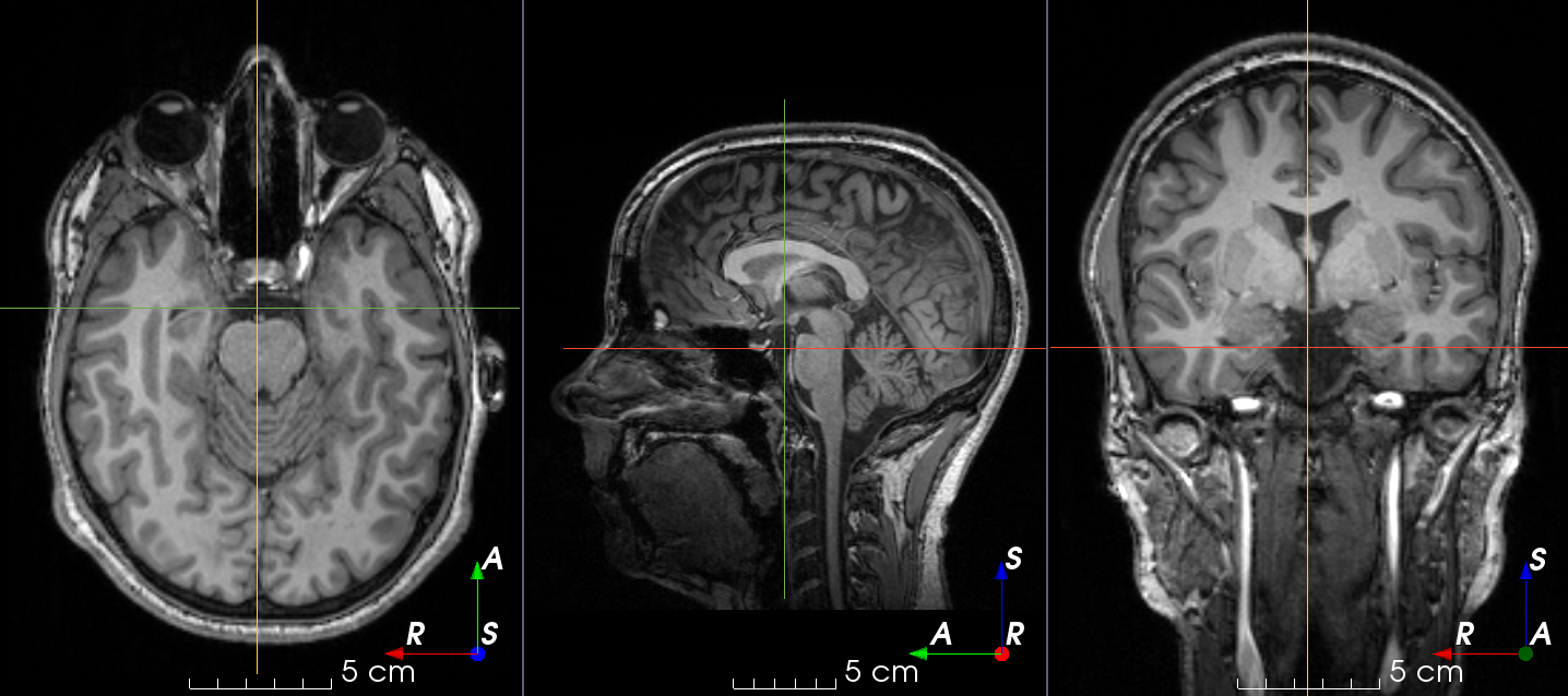 MRI k-space spike artifacts