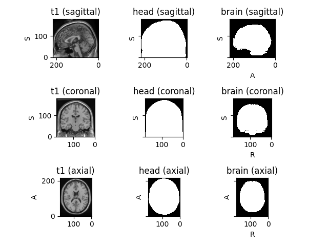 t1 (sagittal), head (sagittal), brain (sagittal), t1 (coronal), head (coronal), brain (coronal), t1 (axial), head (axial), brain (axial)