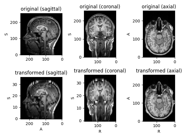 original (sagittal), original (coronal), original (axial), transformed (sagittal), transformed (coronal), transformed (axial)