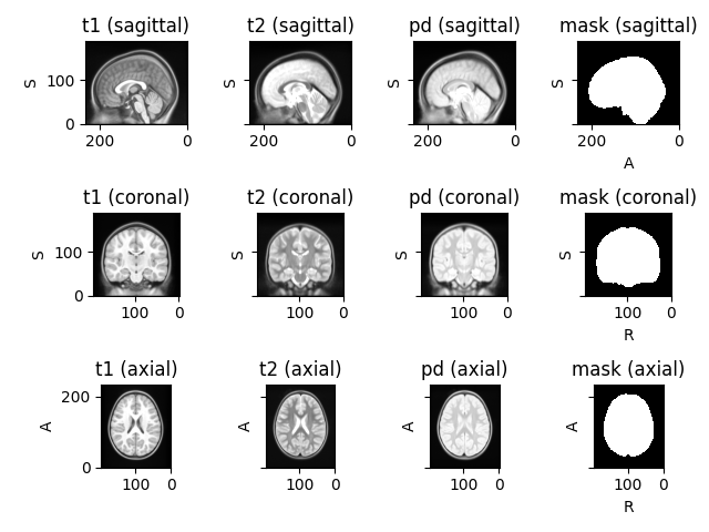 t1 (sagittal), t2 (sagittal), pd (sagittal), mask (sagittal), t1 (coronal), t2 (coronal), pd (coronal), mask (coronal), t1 (axial), t2 (axial), pd (axial), mask (axial)